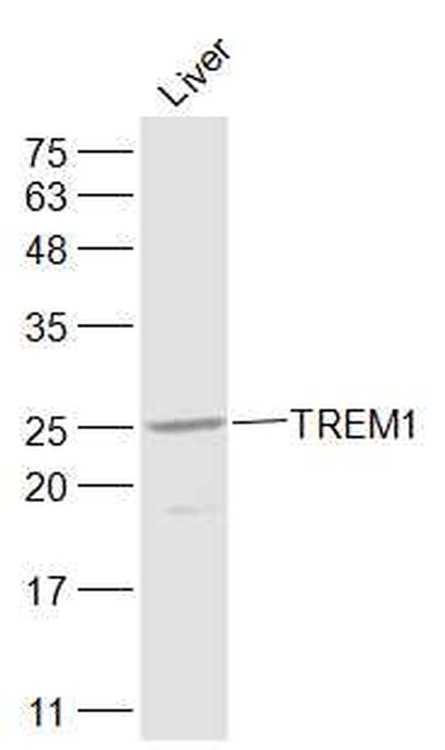 TREM1 Antibody in Western Blot (WB)