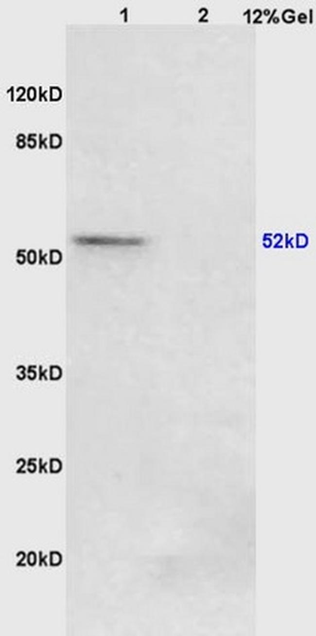 Phospho-PPAR Gamma (Ser273) Antibody in Western Blot (WB)