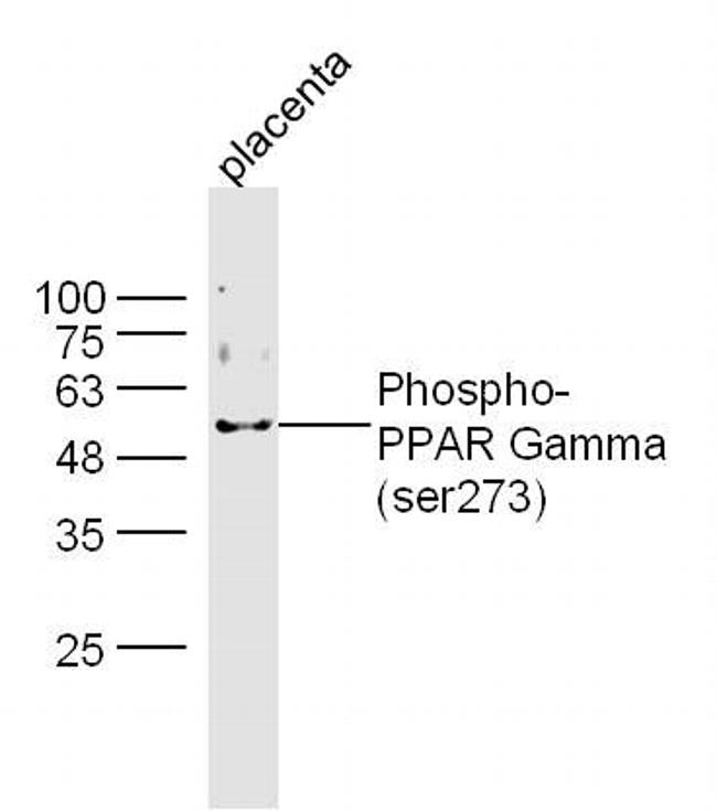 Phospho-PPAR Gamma (Ser273) Antibody in Western Blot (WB)