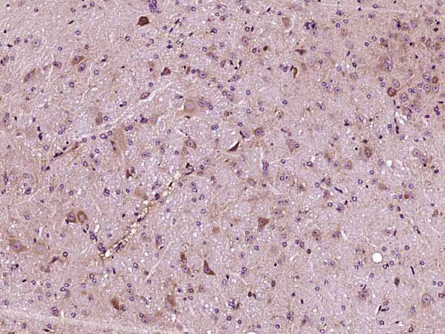 Apolipoprotein E Antibody in Immunohistochemistry (Paraffin) (IHC (P))