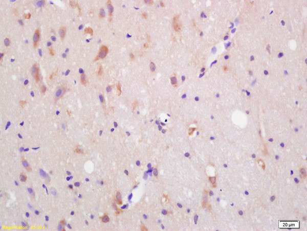 CXCR7/RDC1 Antibody in Immunohistochemistry (Paraffin) (IHC (P))