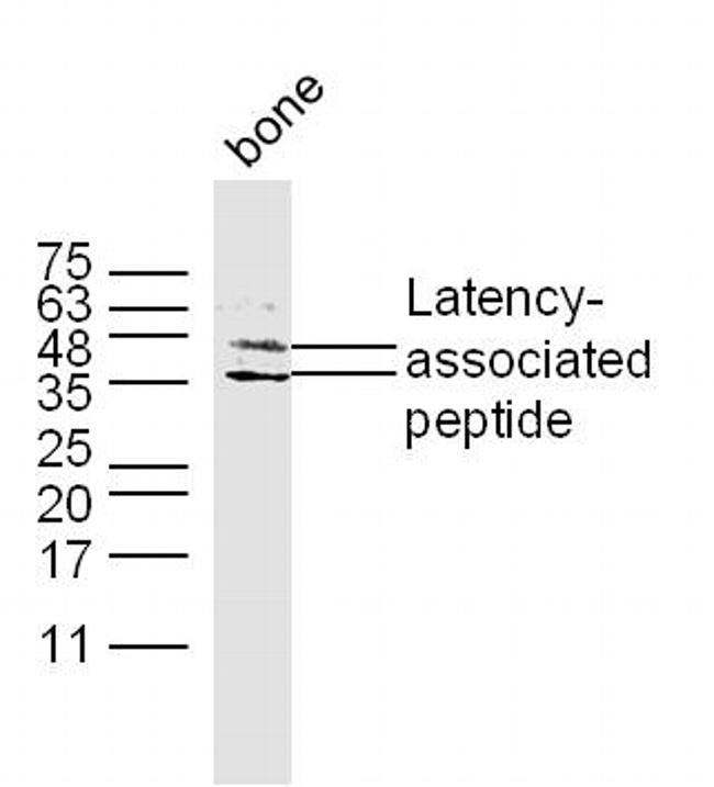 TGFB1 Antibody in Western Blot (WB)