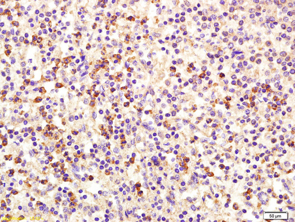 MCSF Antibody in Immunohistochemistry (Paraffin) (IHC (P))