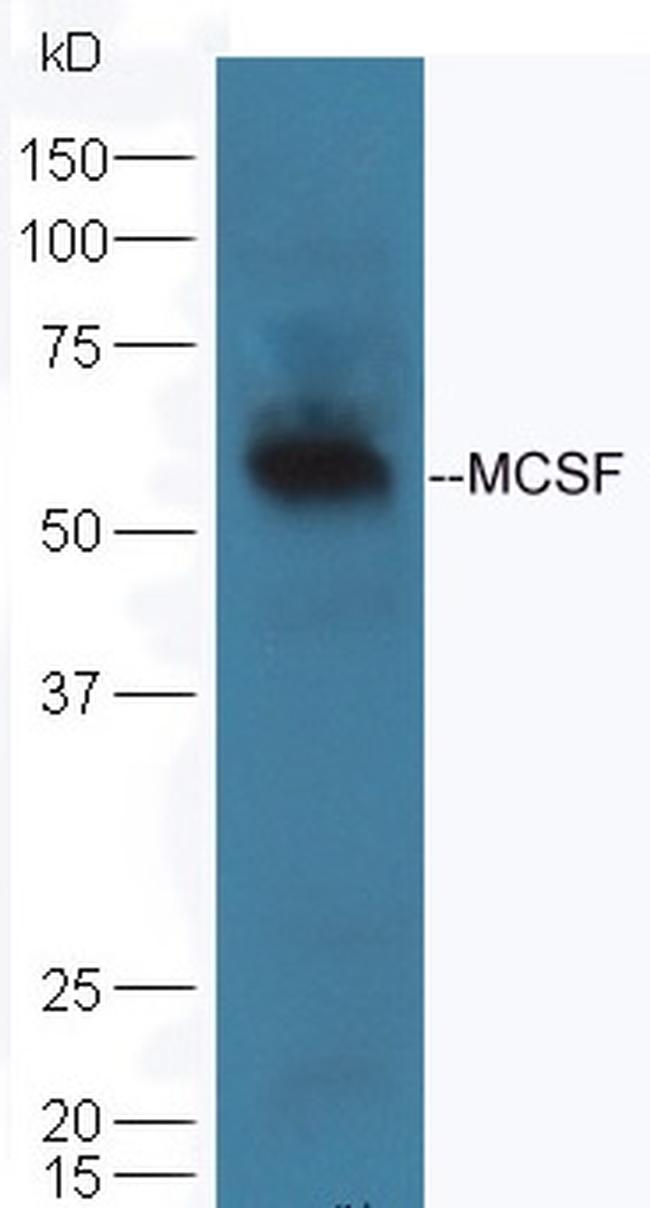 MCSF Antibody in Western Blot (WB)