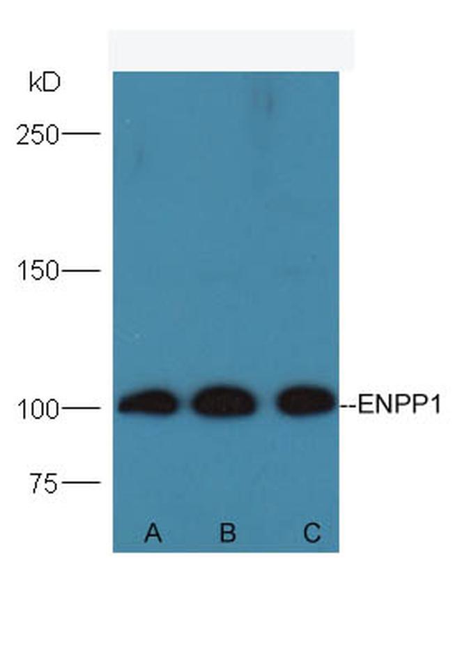 ENPP1 Antibody in Western Blot (WB)