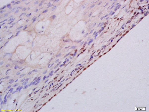 MSH3 Antibody in Immunohistochemistry (Paraffin) (IHC (P))