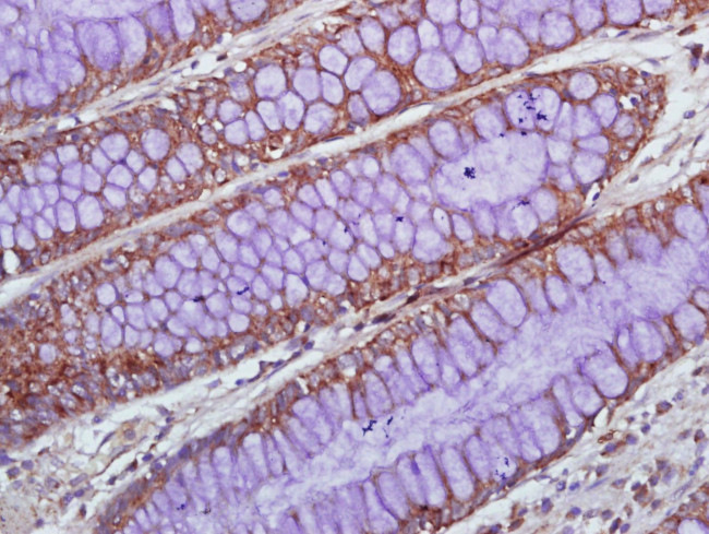 IL-1 Alpha Antibody in Immunohistochemistry (Paraffin) (IHC (P))