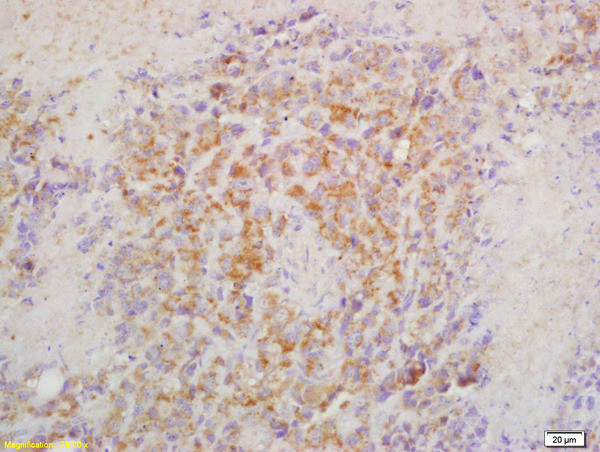 CRTAM Antibody in Immunohistochemistry (Paraffin) (IHC (P))