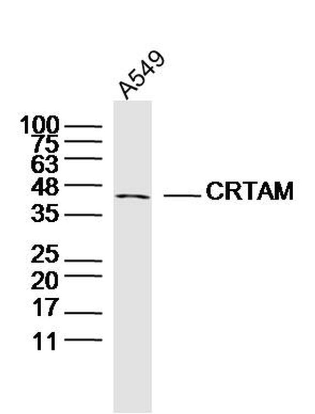 CRTAM Antibody in Western Blot (WB)