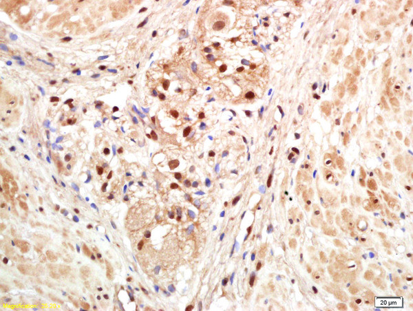 PAPOG Antibody in Immunohistochemistry (Paraffin) (IHC (P))