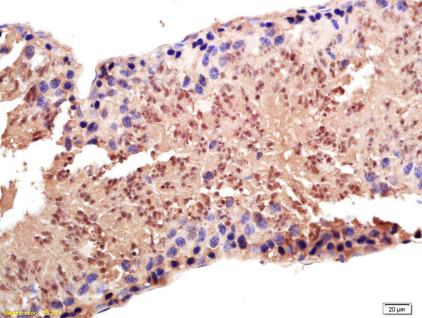 PAPOG Antibody in Immunohistochemistry (Paraffin) (IHC (P))