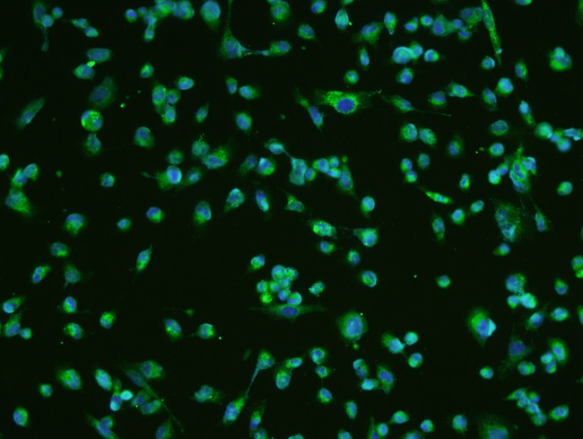 BDNF Antibody in Immunocytochemistry (ICC/IF)