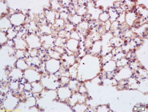 Insulin receptor subunit beta Antibody in Immunohistochemistry (Paraffin) (IHC (P))