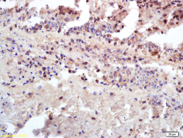 Insulin receptor subunit beta Antibody in Immunohistochemistry (Paraffin) (IHC (P))