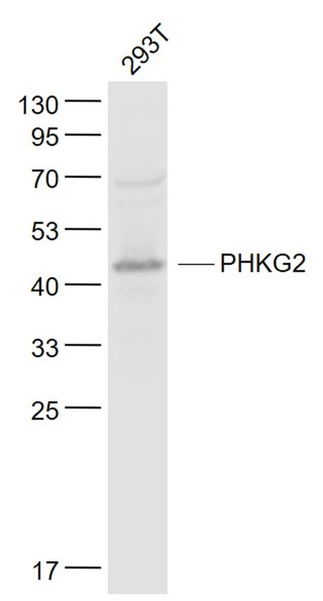 PHKG2 Antibody in Western Blot (WB)