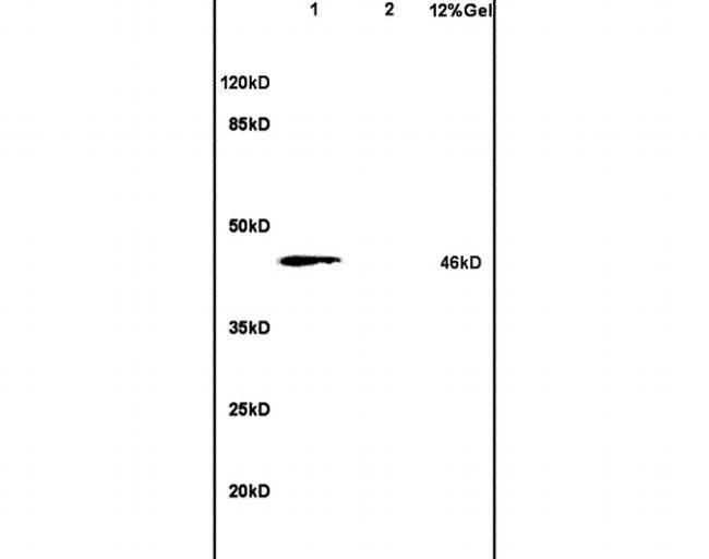 PHKG2 Antibody in Western Blot (WB)