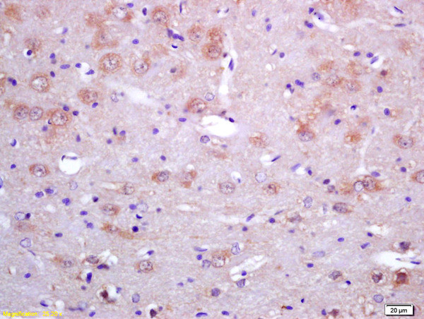 SAHH Antibody in Immunohistochemistry (Paraffin) (IHC (P))