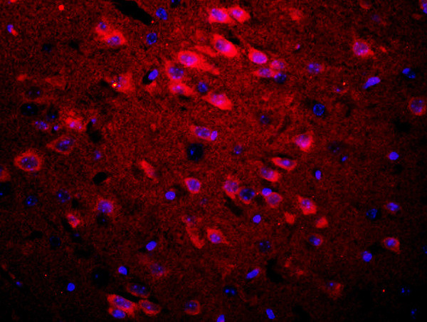 APOE Antibody in Immunohistochemistry (Paraffin) (IHC (P))