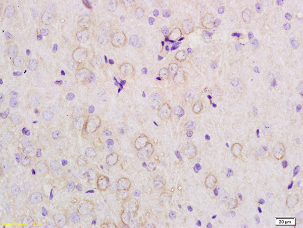 APOE Antibody in Immunohistochemistry (Paraffin) (IHC (P))