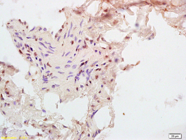 CPT1B Antibody in Immunohistochemistry (Paraffin) (IHC (P))