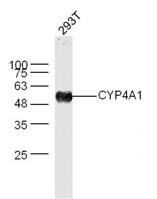 Cytochrome P450 4A Antibody in Western Blot (WB)