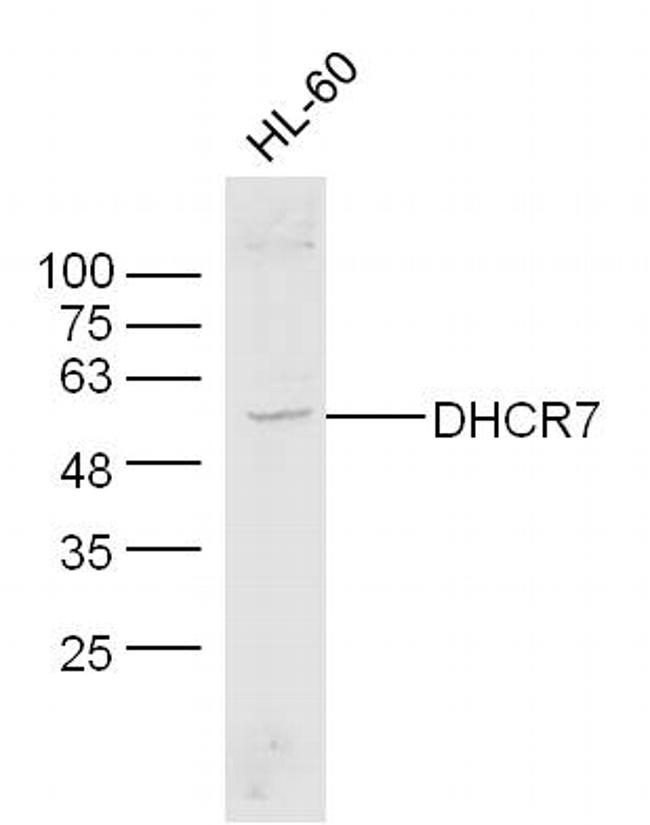 DHCR7 Antibody in Western Blot (WB)