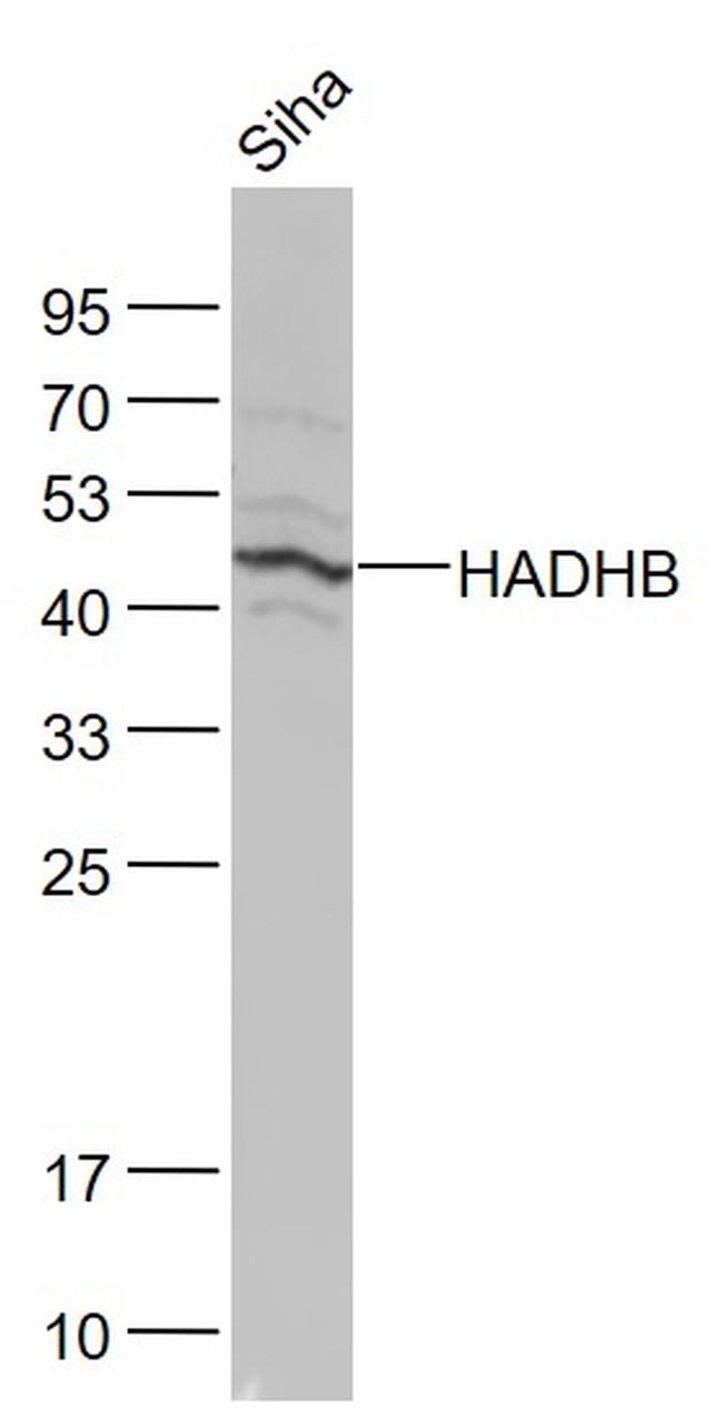 HADHB Antibody in Western Blot (WB)