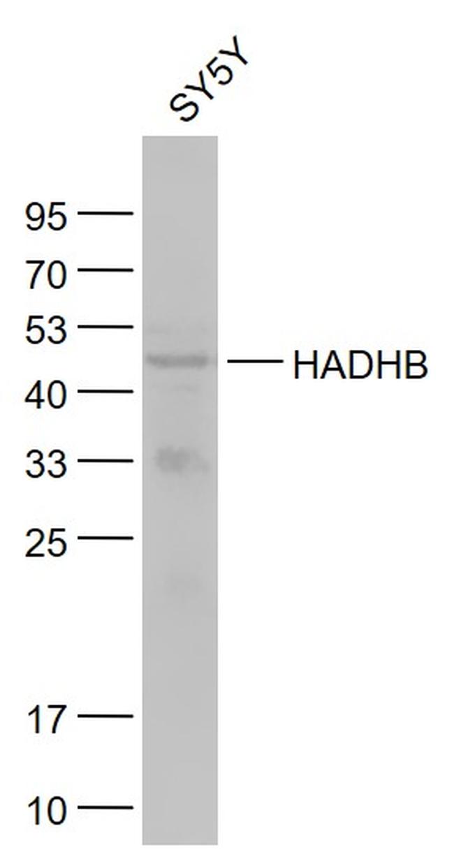 HADHB Antibody in Western Blot (WB)