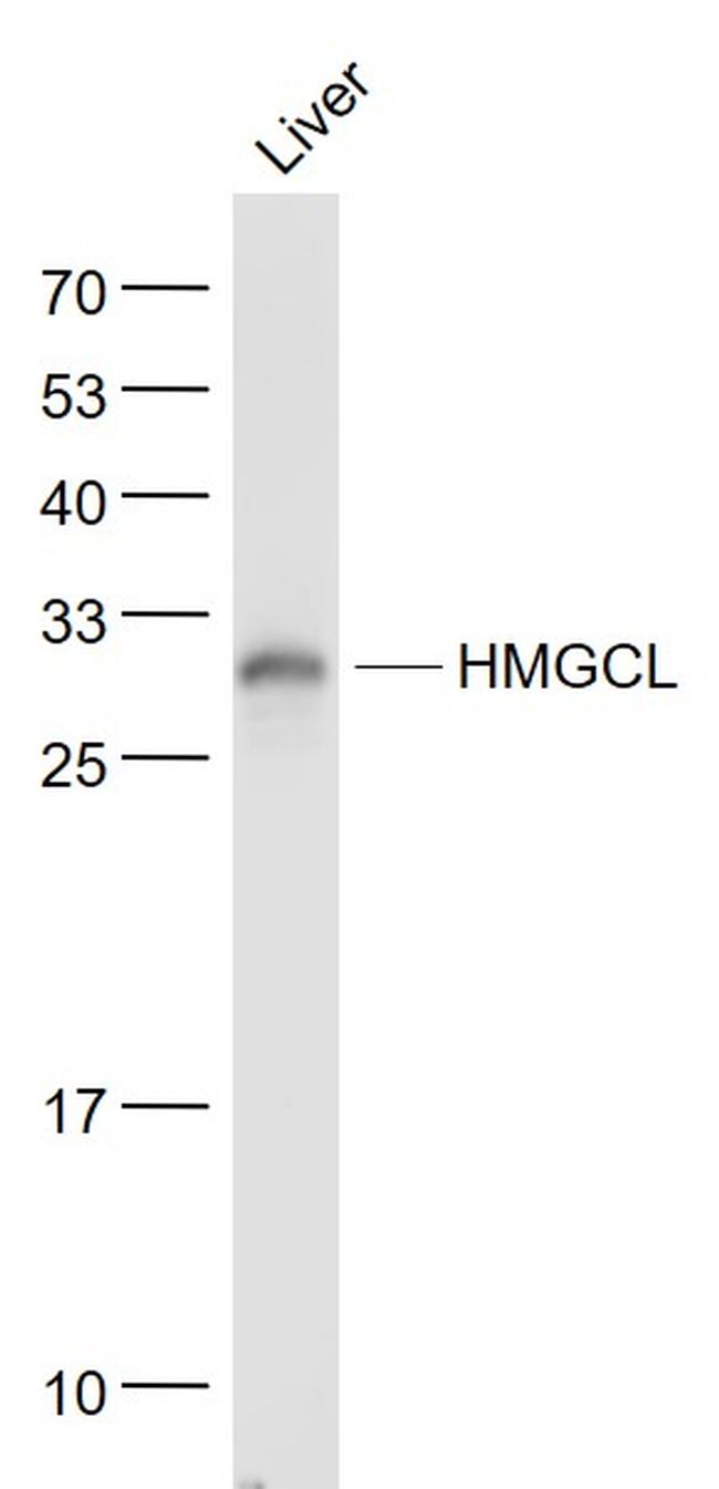 HMGCL Antibody in Western Blot (WB)