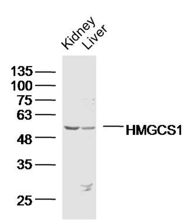 HMGCS1 Antibody in Western Blot (WB)