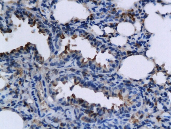 TNFSF15 Antibody in Immunohistochemistry (Paraffin) (IHC (P))