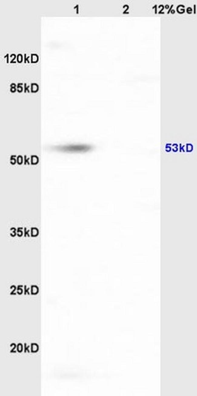 HCLS1 Antibody in Western Blot (WB)