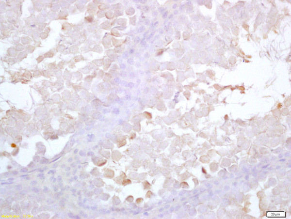 Acrosin Antibody in Immunohistochemistry (Paraffin) (IHC (P))