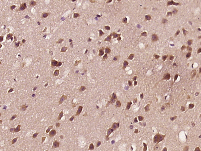 Phospho-APBB1 (Ser175) Antibody in Immunohistochemistry (Paraffin) (IHC (P))