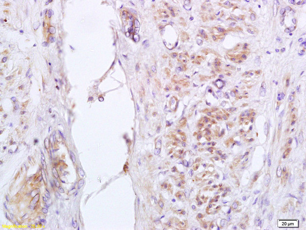 Phospho-GADD153 (Ser30) Antibody in Immunohistochemistry (Paraffin) (IHC (P))