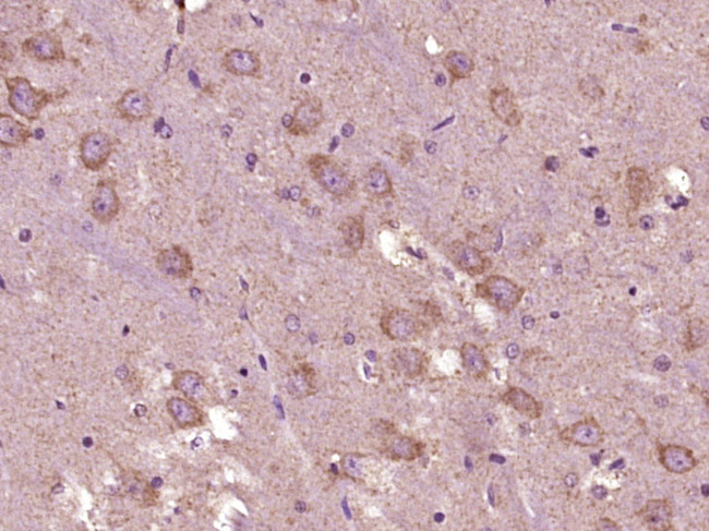 Phospho-GADD153 (Ser30) Antibody in Immunohistochemistry (Paraffin) (IHC (P))