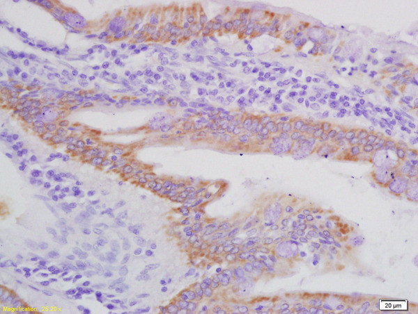 AXL Antibody in Immunohistochemistry (Paraffin) (IHC (P))