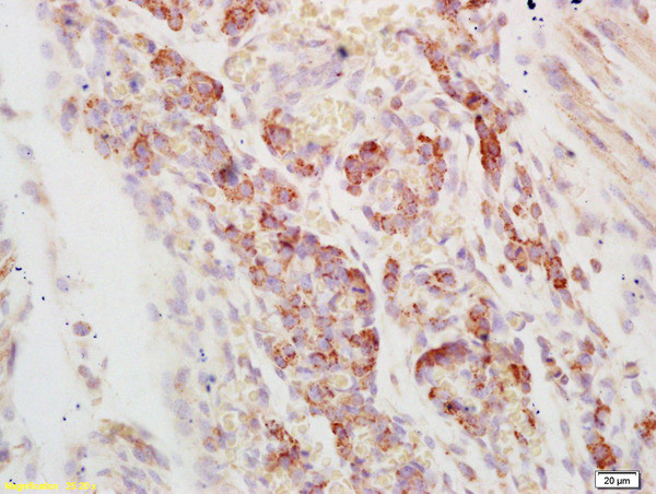 AXL Antibody in Immunohistochemistry (Paraffin) (IHC (P))