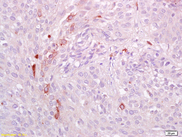 Phospho-AXL (Tyr698, Tyr702, Tyr703) Antibody in Immunohistochemistry (Paraffin) (IHC (P))