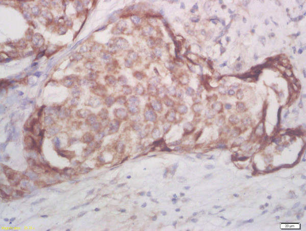 Phospho-AKT1/2/3 (Thr305, Thr308, Thr309) Antibody in Immunohistochemistry (Paraffin) (IHC (P))