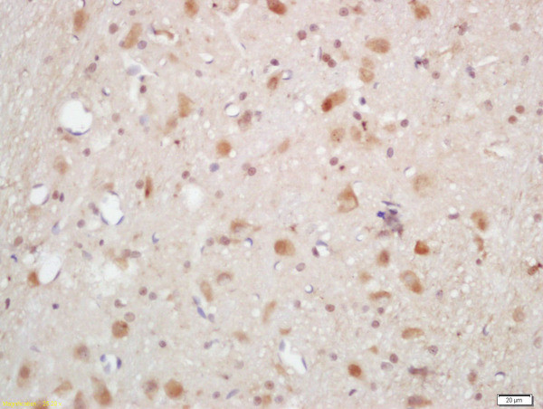 Phospho-AKT1/2/3 (Thr305, Thr308, Thr309) Antibody in Immunohistochemistry (Paraffin) (IHC (P))