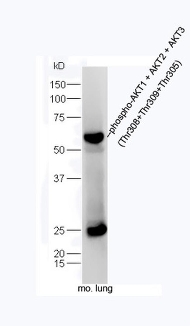 Phospho-AKT1/2/3 (Thr305, Thr308, Thr309) Antibody in Western Blot (WB)