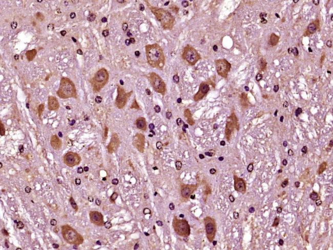 Phospho-Bcl-2Thr129 (Thr129) Antibody in Immunohistochemistry (Paraffin) (IHC (P))