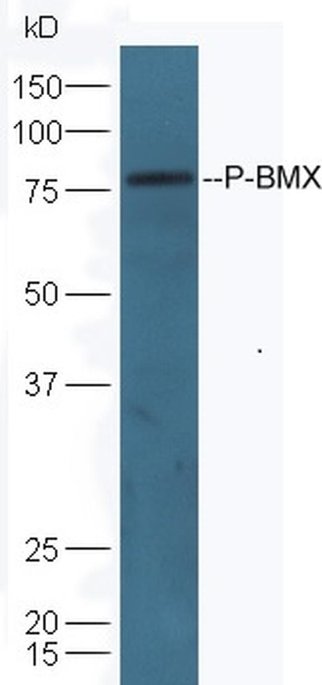 Phospho-BMX (Tyr566) Antibody in Western Blot (WB)