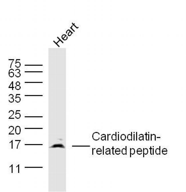 Cardiodilatin-related peptide Antibody in Western Blot (WB)