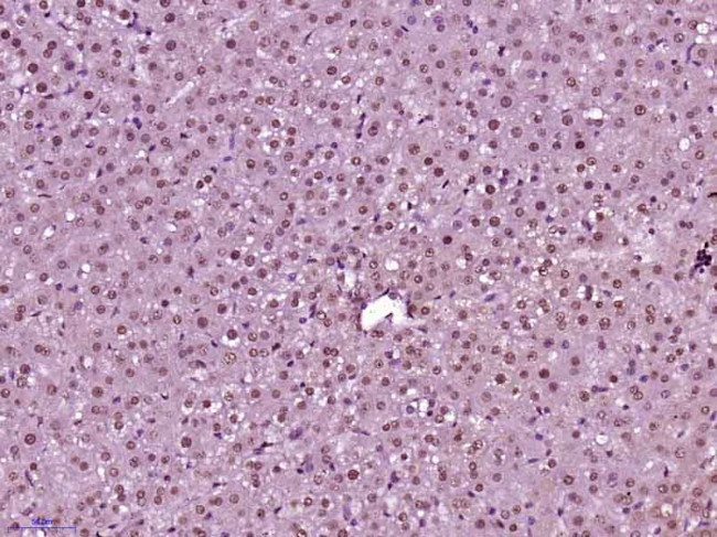 Phospho-CDKN1A (Thr145) Antibody in Immunohistochemistry (Paraffin) (IHC (P))