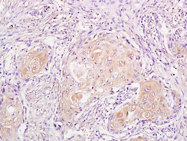 Phospho-CDKN1A (Thr57) Antibody in Immunohistochemistry (Paraffin) (IHC (P))