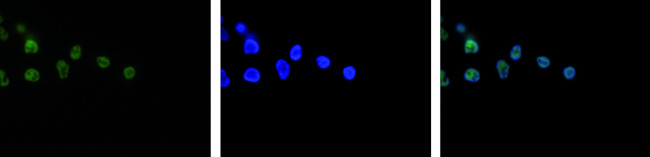 H3K4me3 Antibody in Immunocytochemistry (ICC/IF)