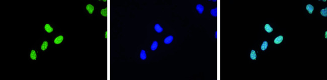 H3K9me3 Antibody in Immunocytochemistry (ICC/IF)