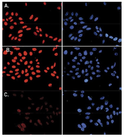 H3K79me3 Antibody in Immunocytochemistry (ICC/IF)